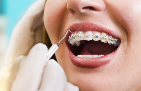 Skerries Orthodontist Nugent Dental